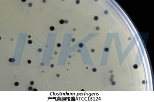 产气荚膜梭菌在SPS培养基上生长特征