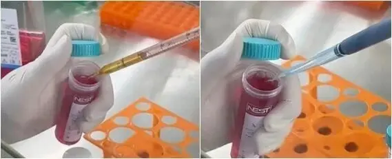 用移液器分别吸取5mL胎牛血清和0.5mL双抗至离心管中